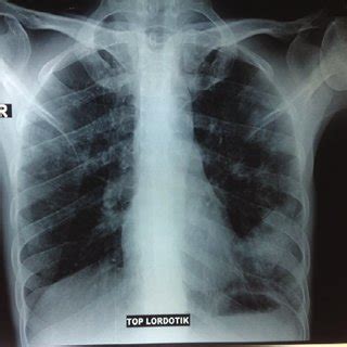 apicolordotic view price philippines|X – RAY Pricelist Item Description PRICE .